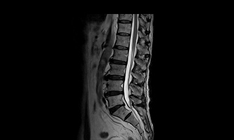 腰椎：ヘルニア、脊柱管狭窄、圧迫骨折などの検査。